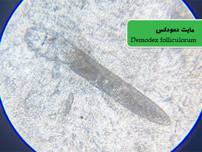 دمودکس فولیکولوروم (Demodex folliculorum)