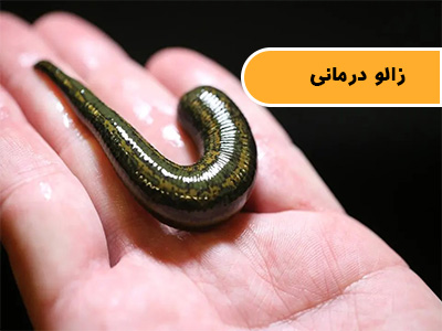 زالو درمانی